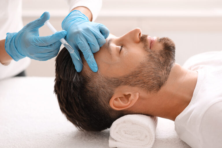 Patient receiving PRP hair restoration treatment at Essentia in 2025, showcasing non-surgical hair growth therapy.