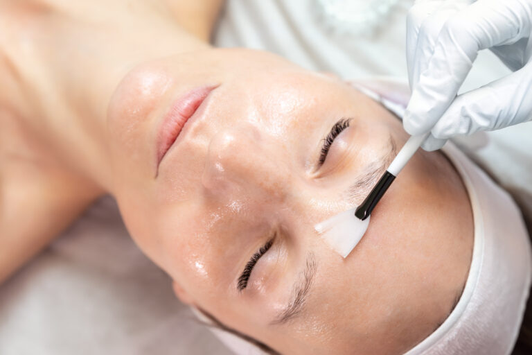 Woman receiving a professional chemical peel treatment at Essentia Women’s Health & Aesthetics
