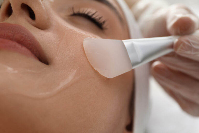 Woman caring for her skin after a chemical peel—applying soothing skincare in a bright spa environment at a Fayetteville skincare clinic.