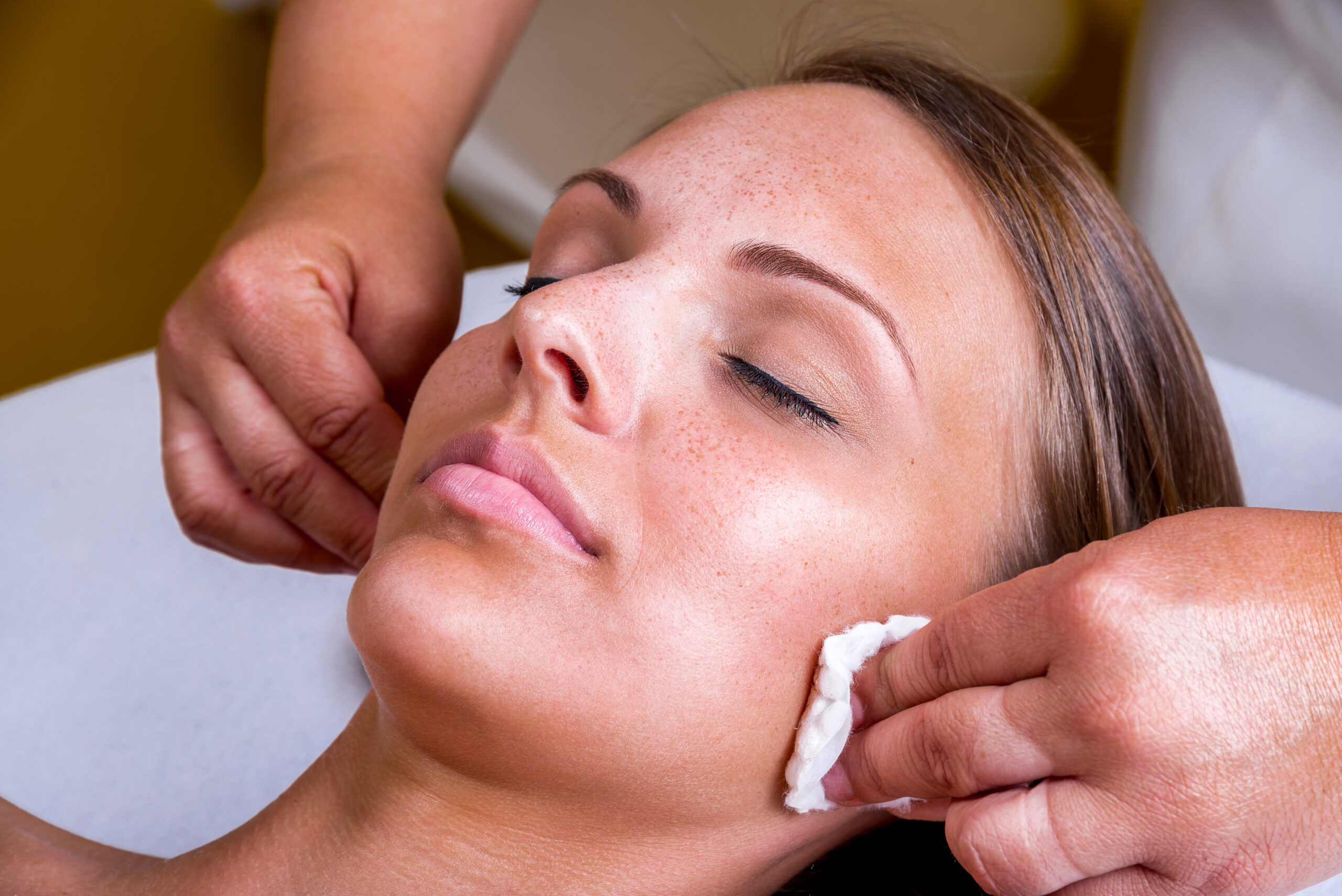 Teen or adult with acne-prone skin receiving a personalized chemical peel treatment at a Fayetteville skincare clinic, with focus on clear results and expert aftercare.